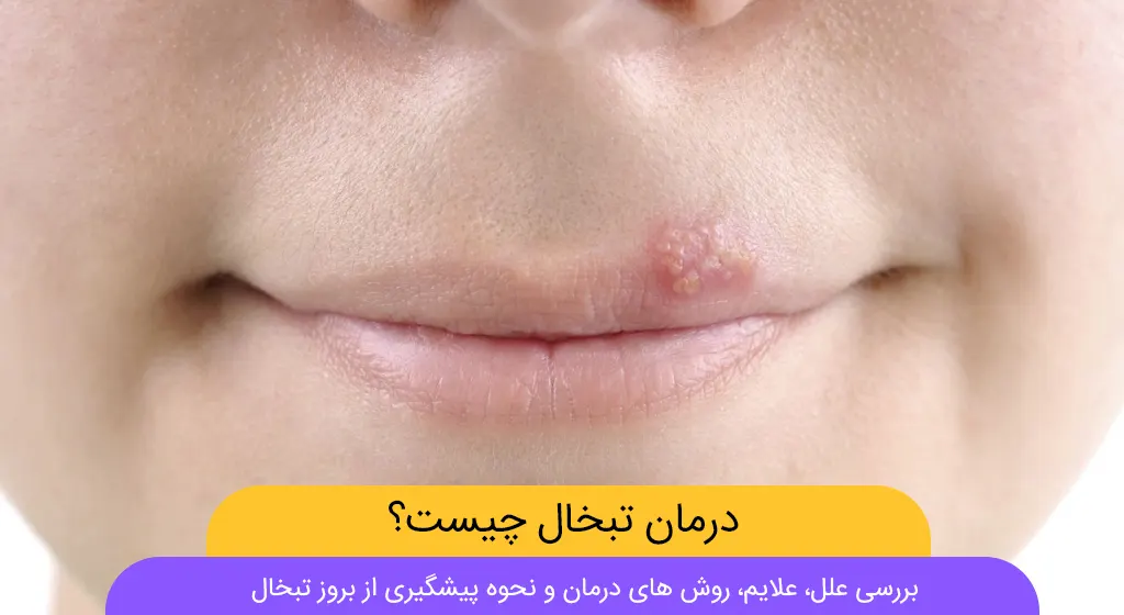عکس تبخال کودکان