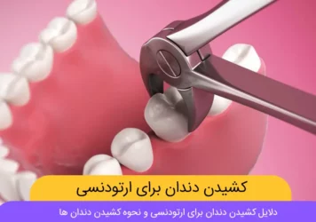 کشیدن دندان برای ارتودنسی