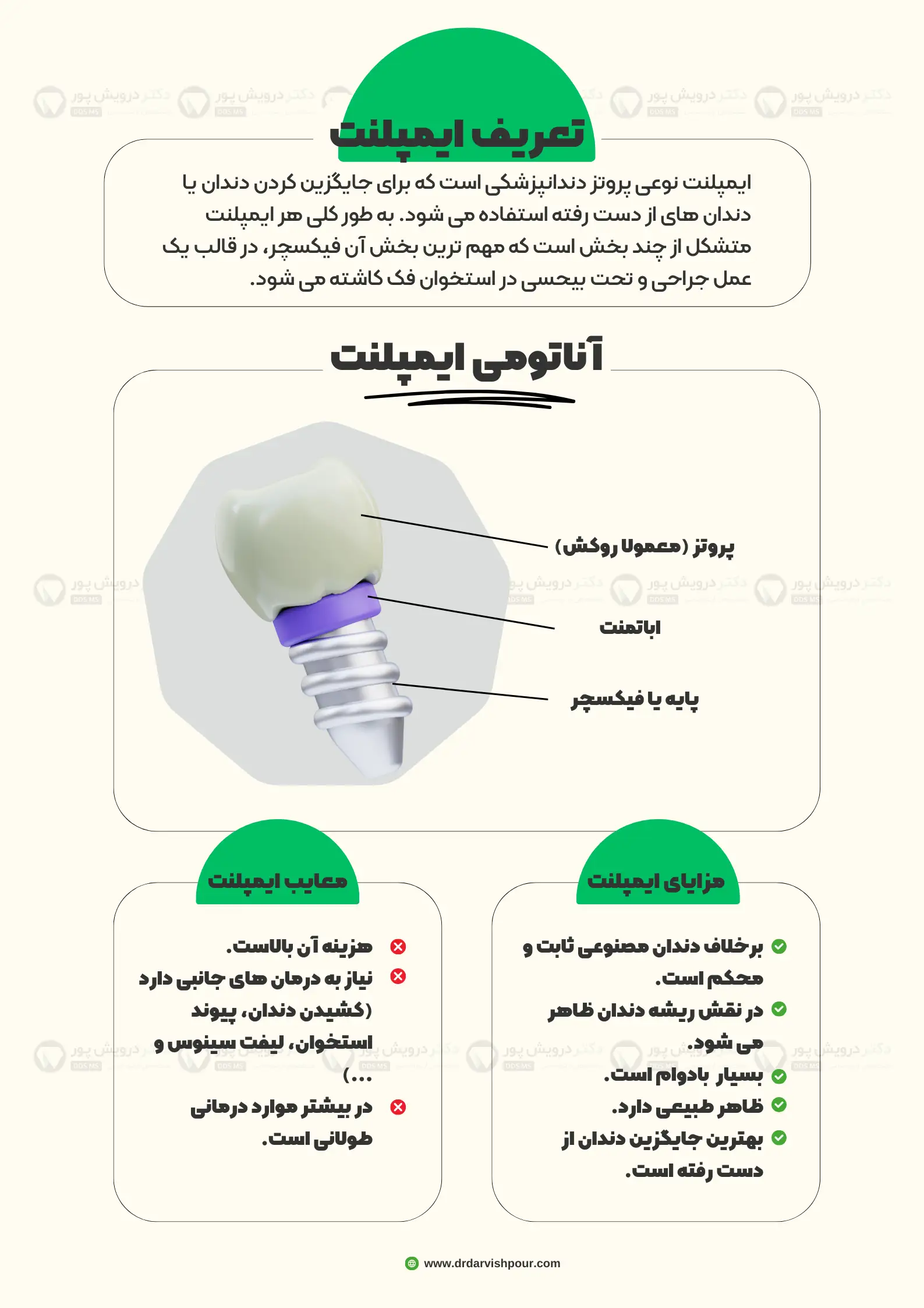 اینفوگرافی ایمپلنت دندان چیست