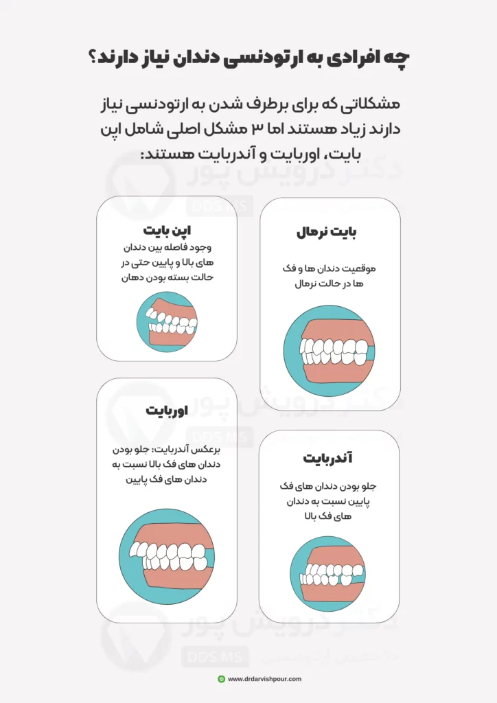 عکس ارتودنسی دندان - ارتودنسی دندان برای چه کسانی است؟ عکس
