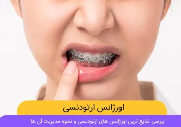 اورژانس ارتودنسی