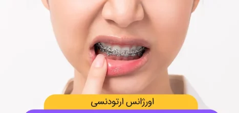 اورژانس ارتودنسی
