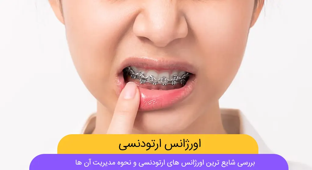 اورژانس ارتودنسی