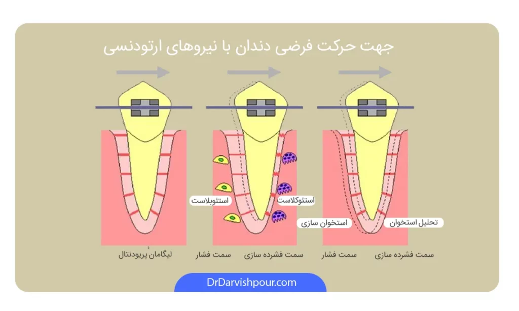 تاثیر سیگار بر حرکات ارتودنسی