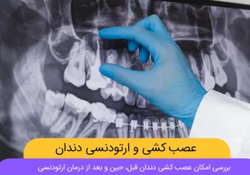 ارتودنسی و عصب کشی دندان
