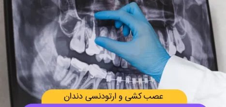 ارتودنسی و عصب کشی دندان