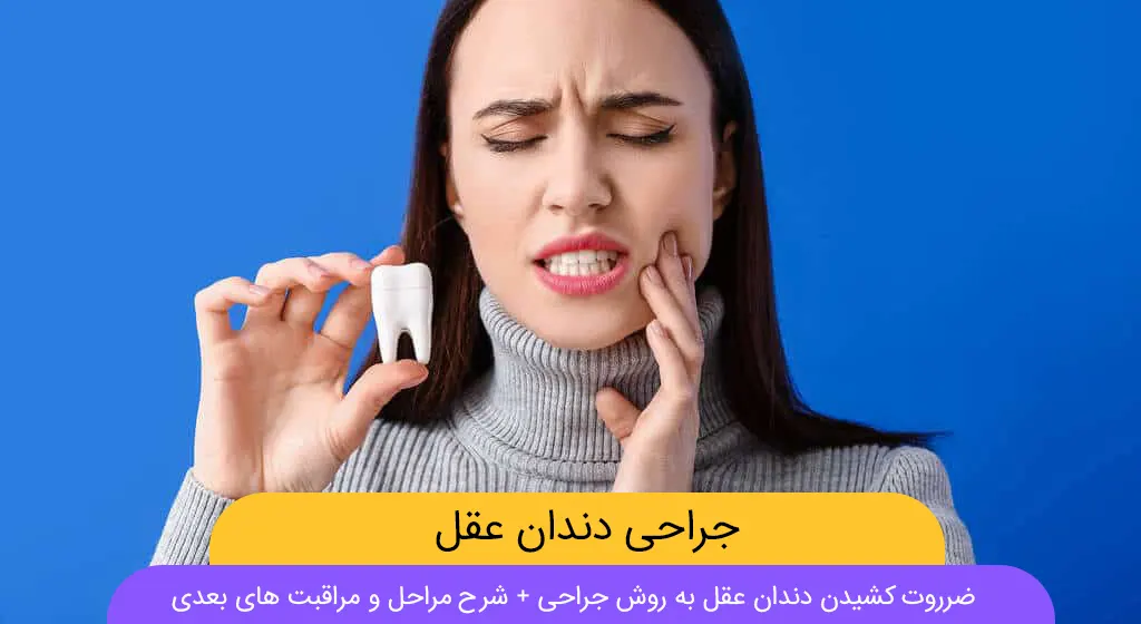 جراحی دندان عقل نهفته عکس