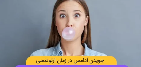 جویدن آدامس در طول درمان ارتودنسی شاخص