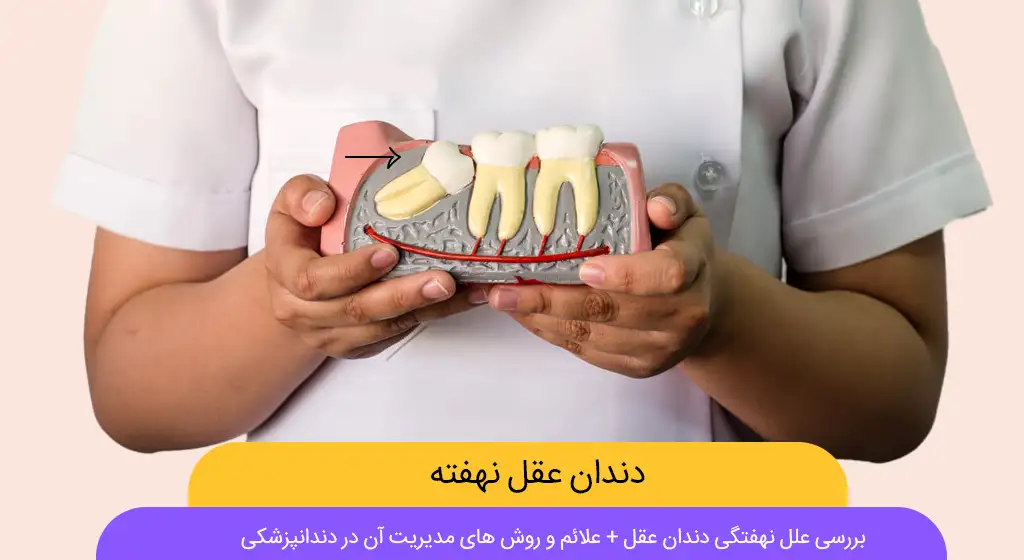 دندان عقل نهفته تصویر شاخص