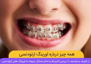 عکس اورینگ ارتودنسی