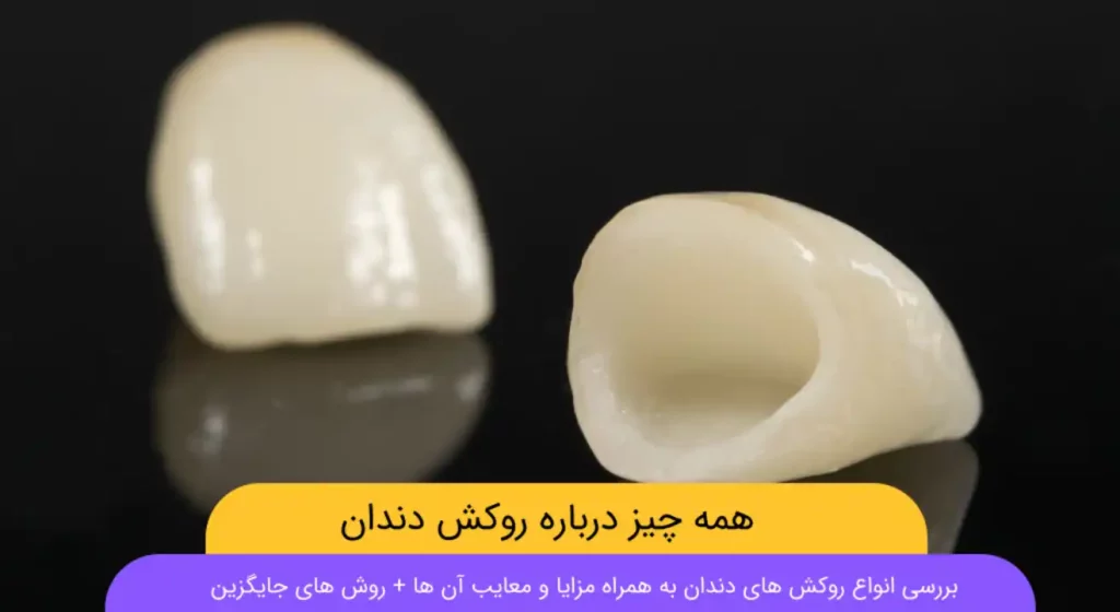 روکش دندان