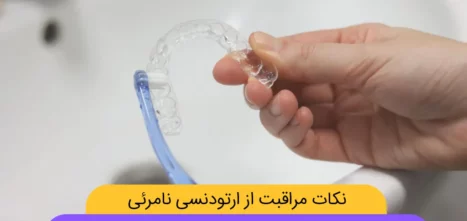مراقبت از ارتودنسی نامرئی تصویر شاخص