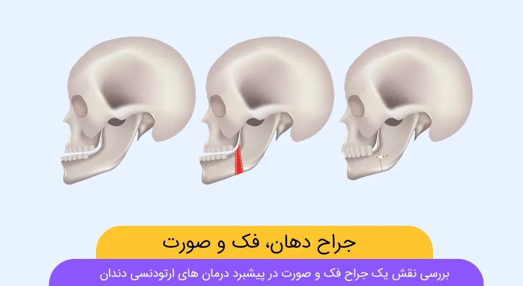 تصویر شاخص جراح فک و صورت