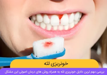 درمان خونریزی لثه