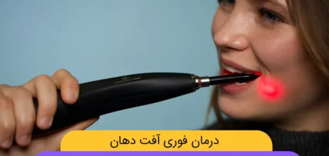 درمان سه سوته آفت دهان