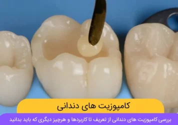 عکس کامپوزیت دندان