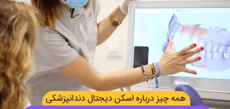 اسکن دیجیتال دندان شاخص