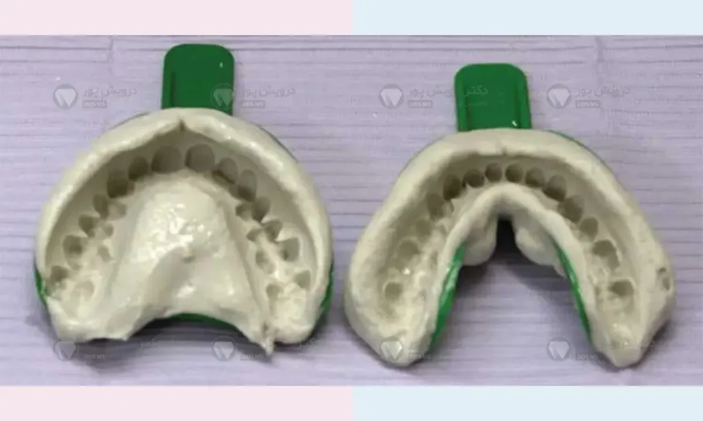 قالبگیری سنتی
