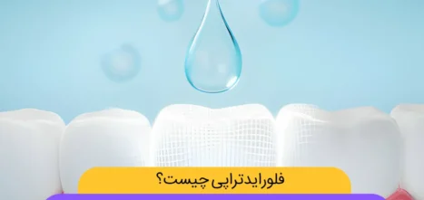 فلورایدتراپی شاخص