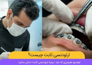 ارتودنسی ثابت چیست شاخص
