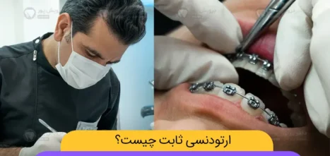 ارتودنسی ثابت چیست شاخص
