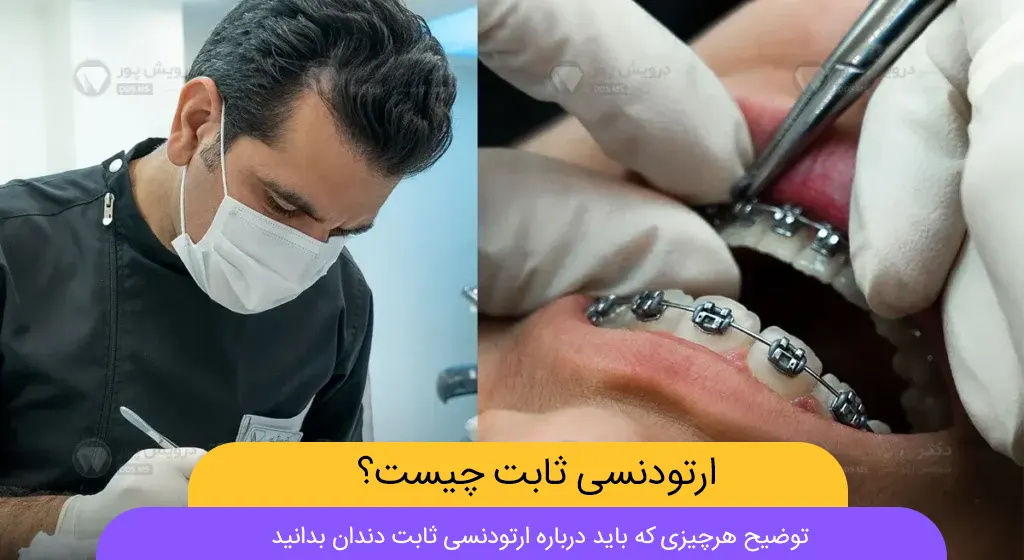 ارتودنسی ثابت چیست شاخص