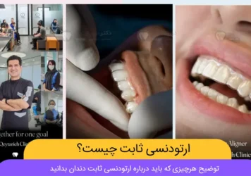 اترودنسی متحرک چیست شاخص