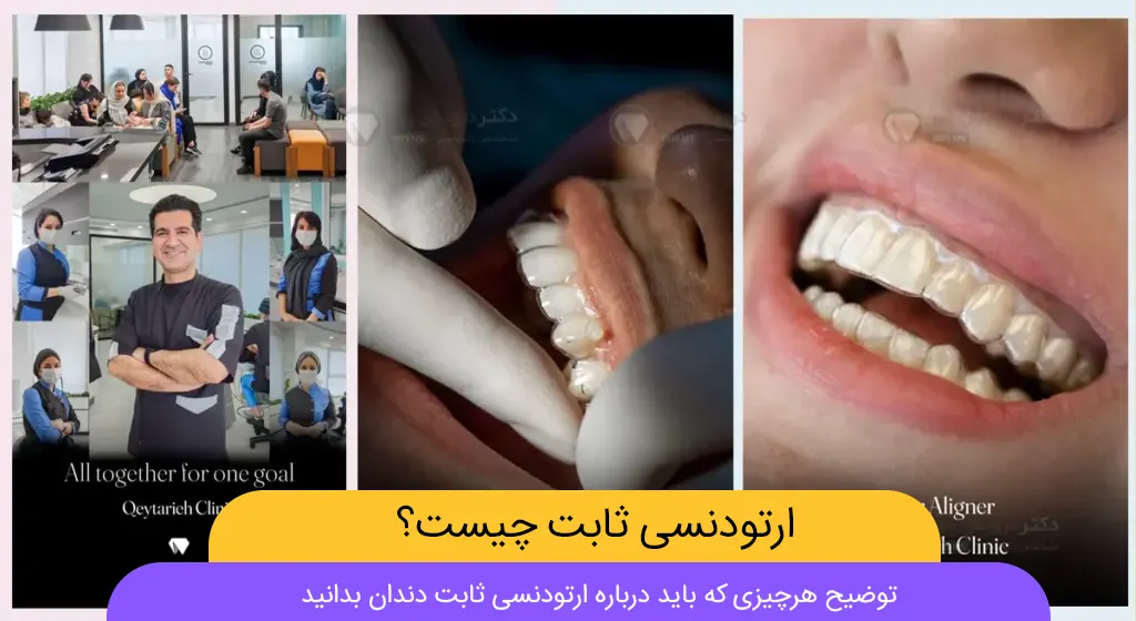 اترودنسی متحرک چیست شاخص