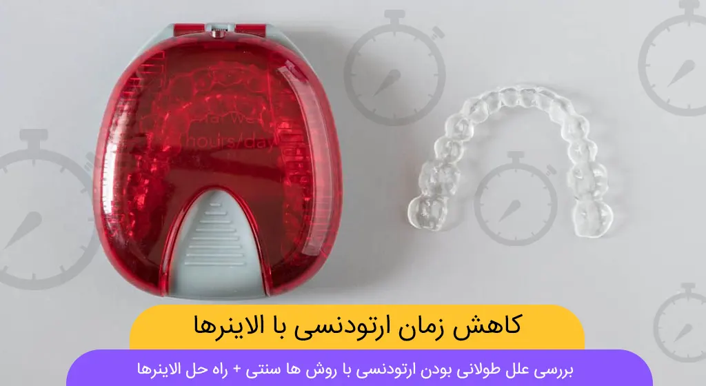 کاهش زمان ارتودنسی با الاینرهای شفاف