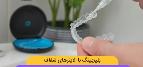 بلیچینگ با الاینرهای شفاف شاخص