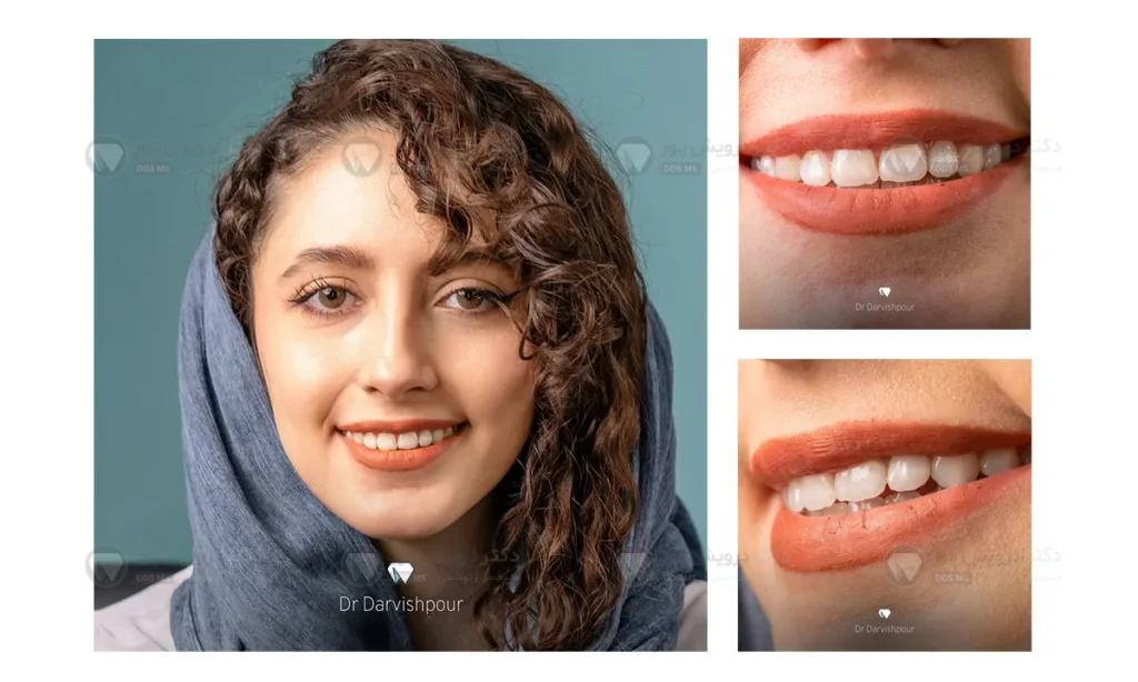 ارتودنسی نامرئی