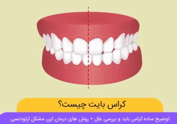 کراس بایت شاخص