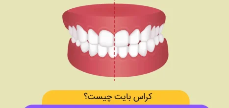 کراس بایت شاخص