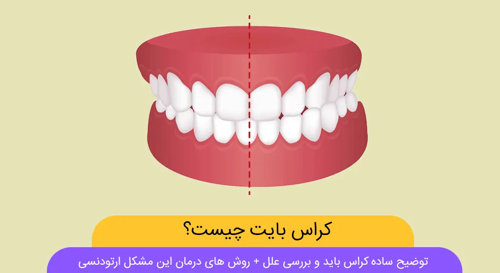 کراس بایت شاخص