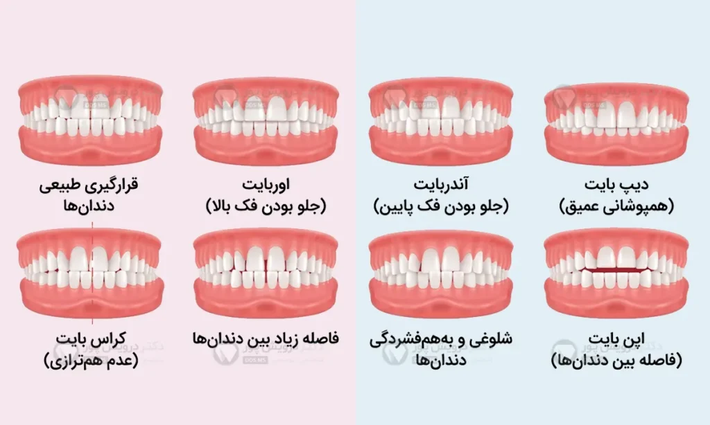 اینفوگرافی انواع نامرتبی های دندانی و فکی