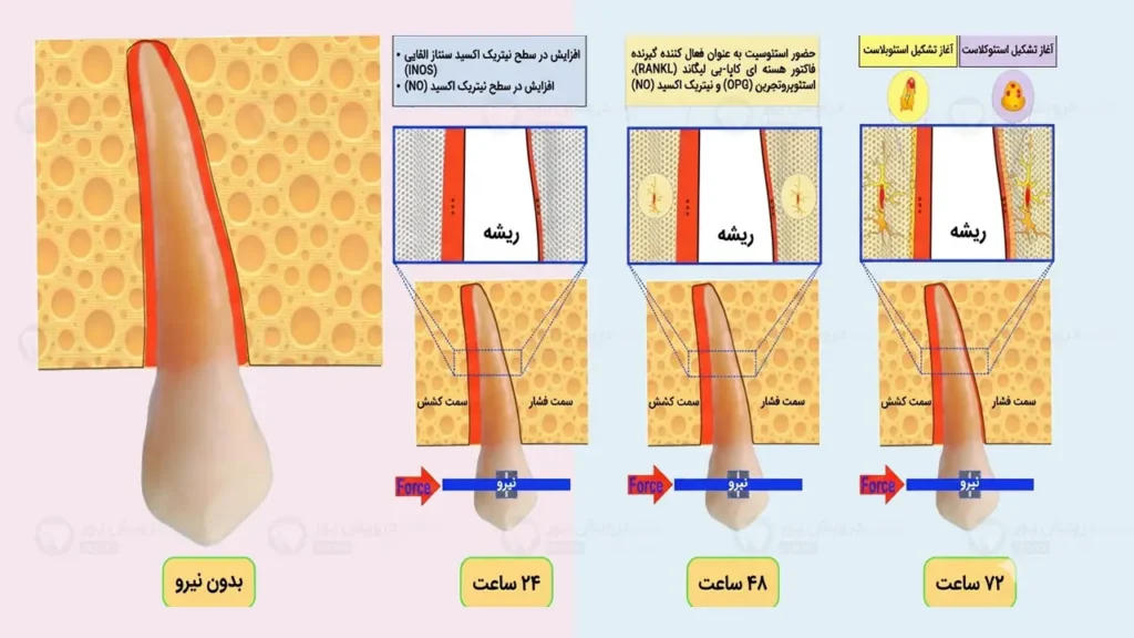 حرکت دندان در طول درمان ارتودنسی