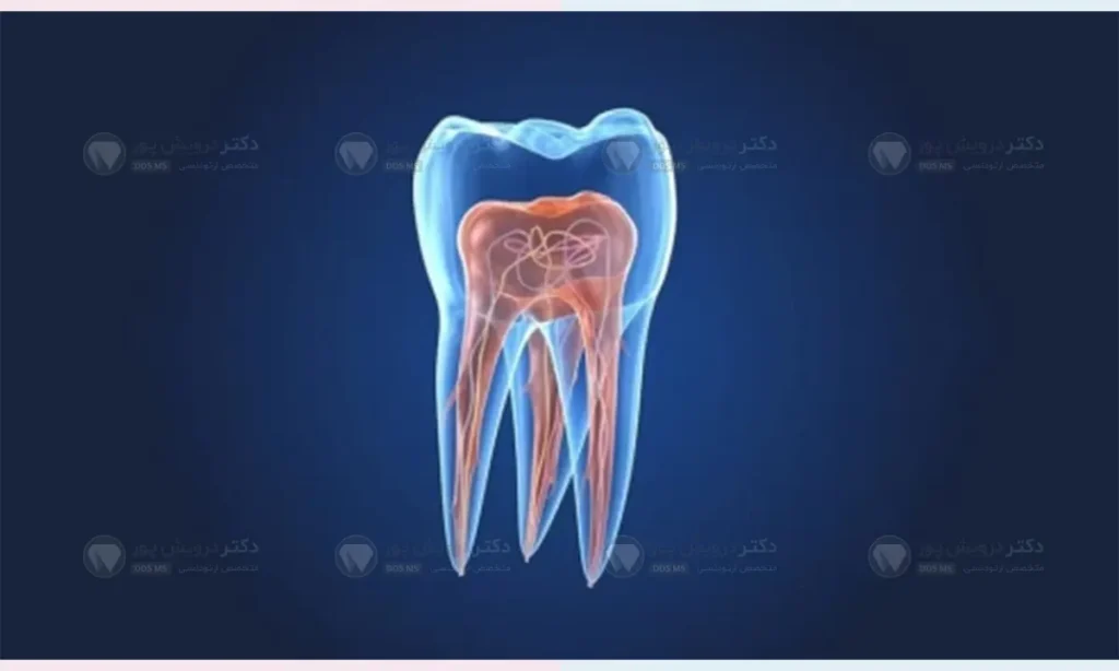 عکس شماتیک پالپ دندان
