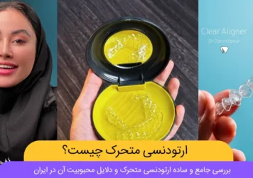 ارتودنسی متحرک شاخص