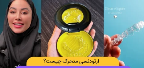 ارتودنسی متحرک شاخص