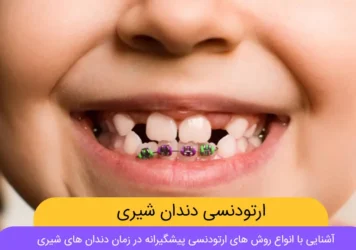 ارتودنسی دندان شیری شاخص