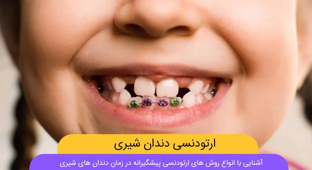 ارتودنسی دندان شیری شاخص