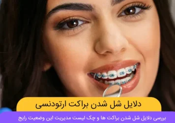 شل شدن براکت های ارتودنسی شاخص