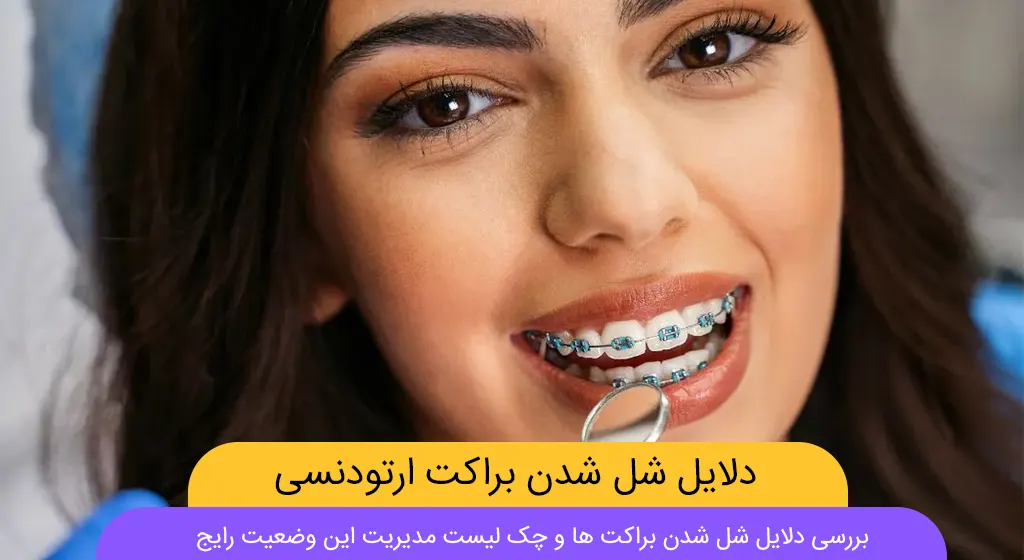 شل شدن براکت های ارتودنسی شاخص