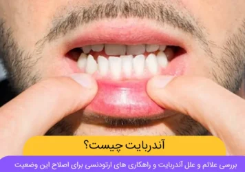 آندربایت شاخص