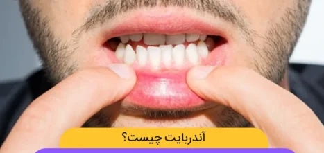 آندربایت شاخص
