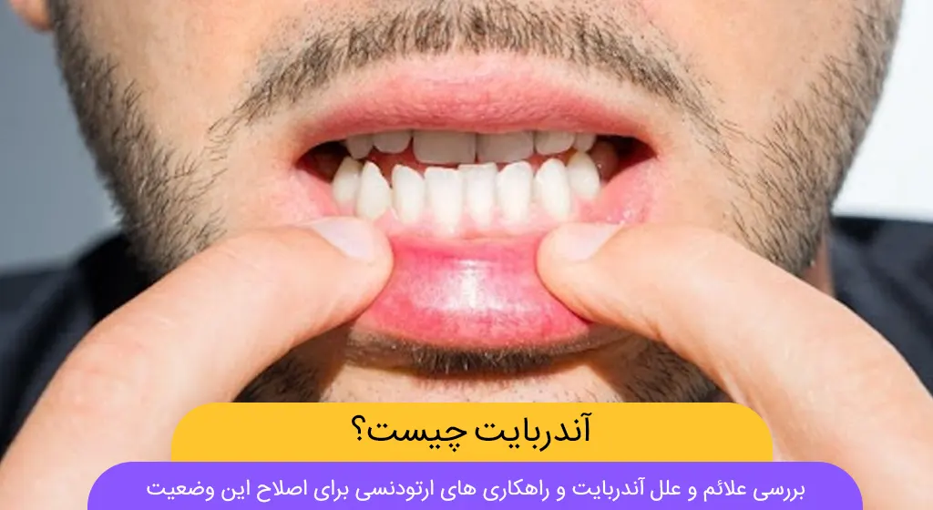 آندربایت شاخص
