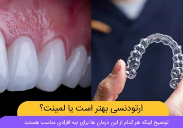 ارتودنسی یا لمینت شاخص
