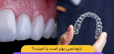 ارتودنسی یا لمینت شاخص