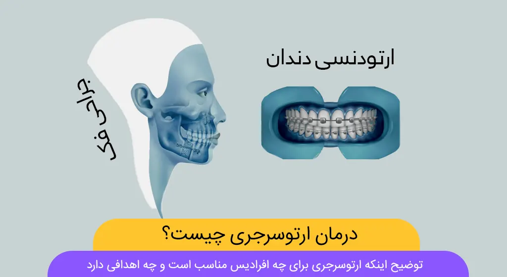 ارتوسرجری شاخص