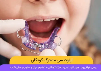 ارتودنسی متحرک کودکان شاخص